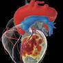 3D cardiac modeling solution for VT ablation receives FDA clearance