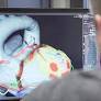 Inheart raises $4.2M for launch of its cloud-based image analysis system for cardiac arrhythmia